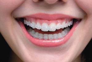 Nha khoa niềng răng mắc cài sứ dây trong uy tín nhất TP. Biên Hòa, Đồng Nai