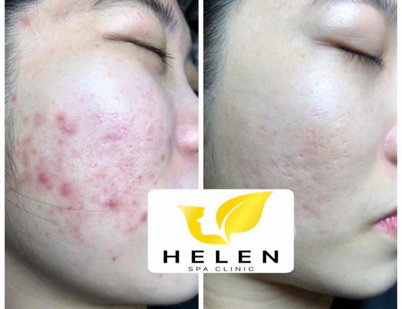 Helen Spa Clinic