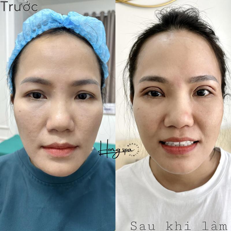 Hồng Spa