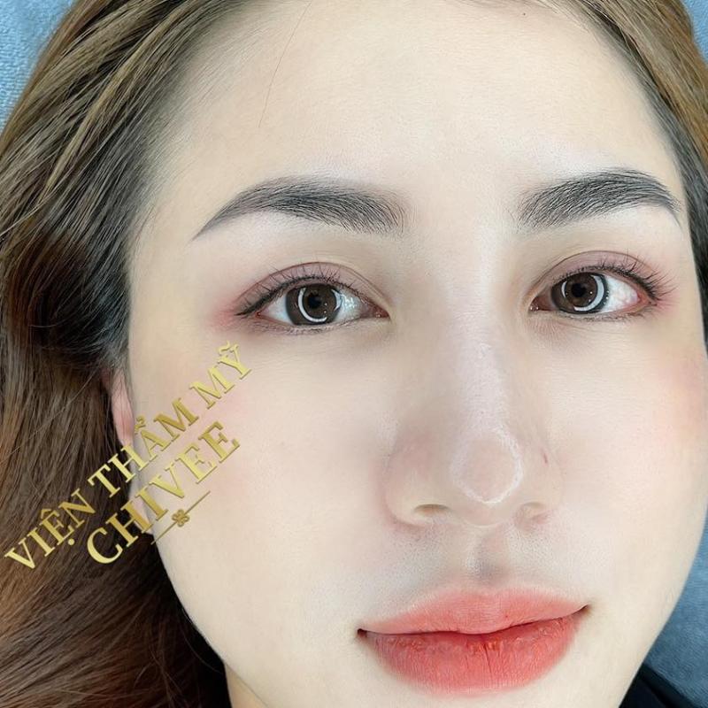 Viện Thẩm Mỹ ChiVee